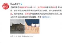 男子等待拔智齿太久难忍剧痛自杀 拔智齿到底有多痛? 男子等待拔智齿太久难忍剧痛自杀 拔智齿到底有多痛?